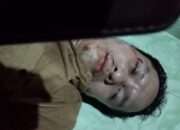 Korban Penganiayaan Merasa Laporannya Diabaikan Polisi